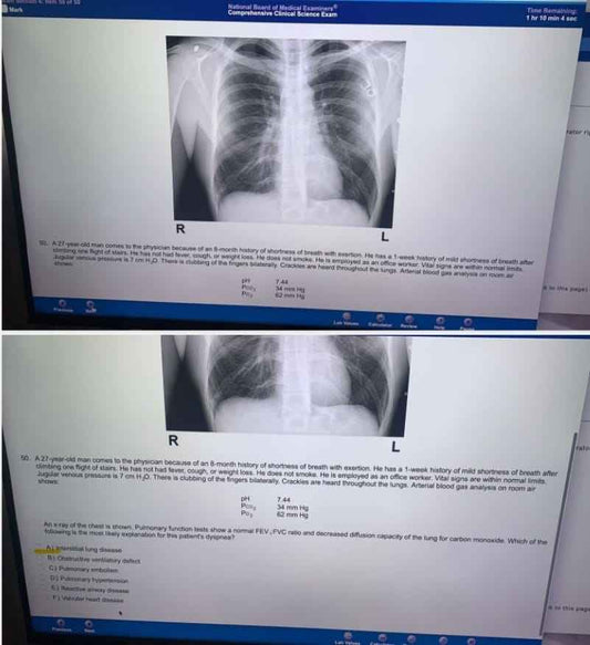 Exam Before Step 2CK: CCSE 2024 Mastery Package - Recalls & Past Papers for Exam Success"