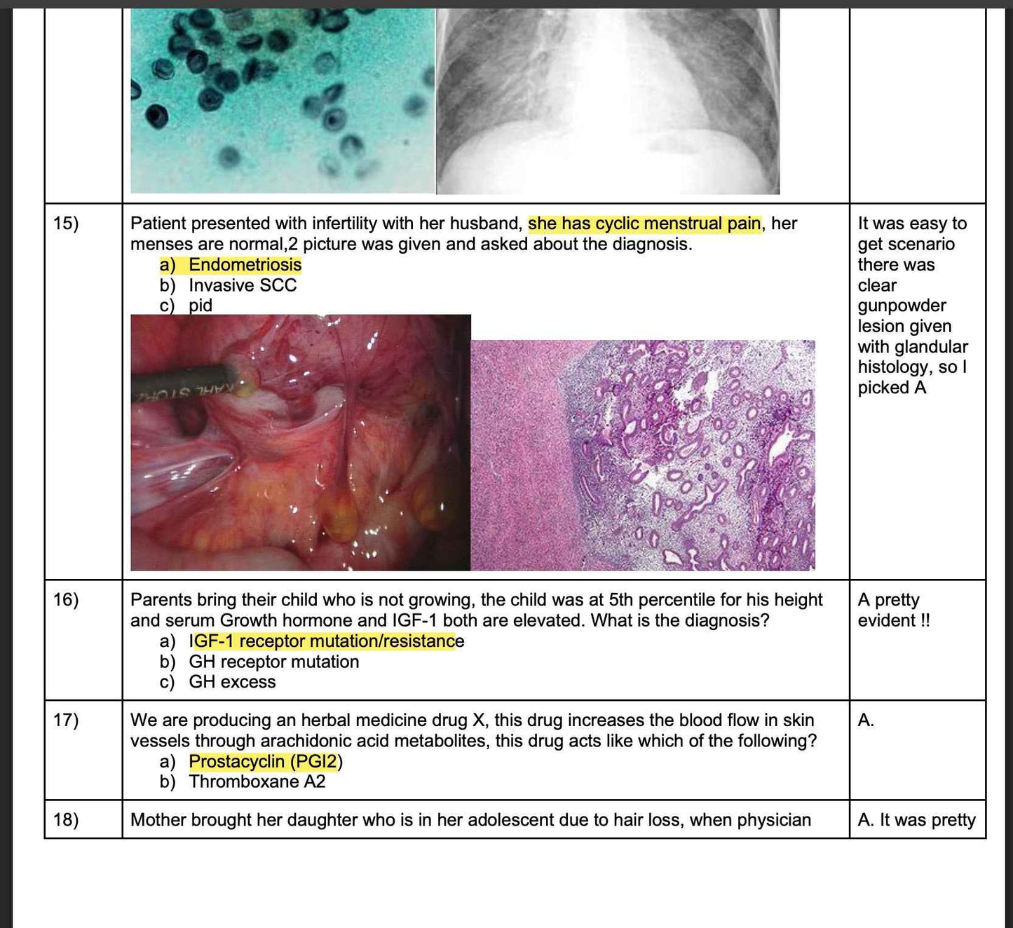 USMLE STEP 1 June–July Recalls 2025–2026 | Past Papers & Biopsies PDF (15 Files) – Latest & Fully Updated