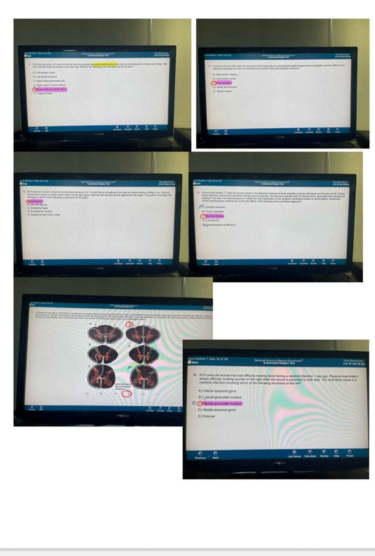 NBME Neuroscience Real Exam Package - Up-to-Date Files (2024)