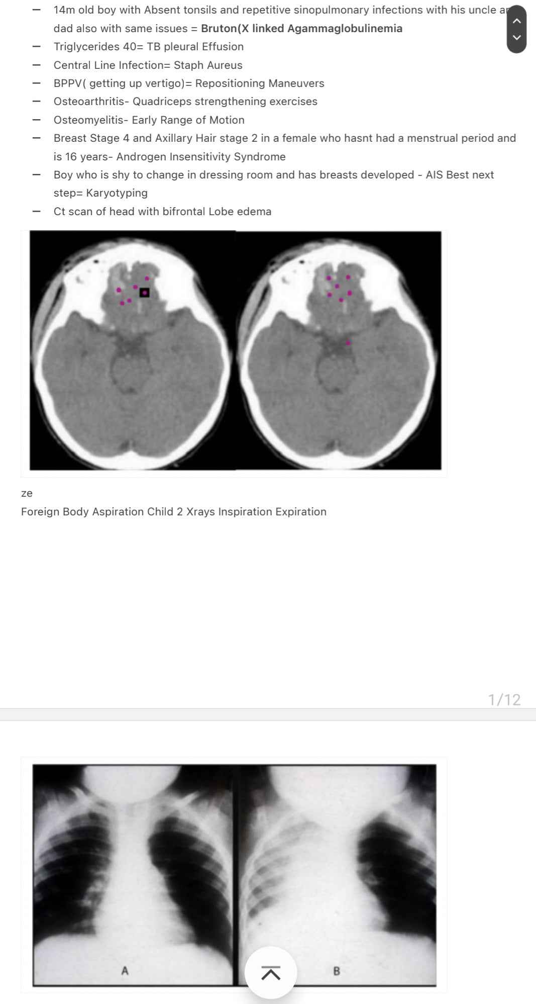 Step 2CK Recalls/Biopsies/Past papers July 2023