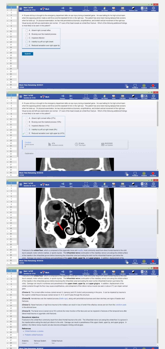 Ace USMLE Step 1 with  Offline Uworld: Comprehensive Subject and System-Based Study Tool!"
