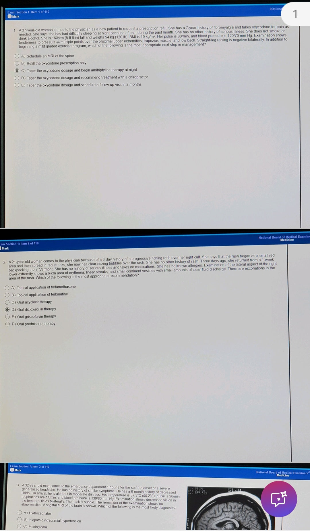 Master Your Internal Medicine Shelf Exam: 2024-2025 Recalls Package"
